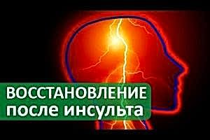 Реабилитация после инсульта