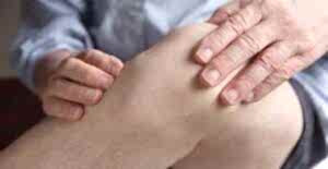 артроз коленного сустава