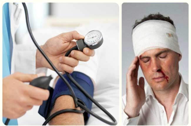 черепно-мозговая травма