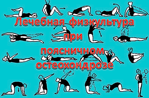 лечебная физкультура при остеохондрозе