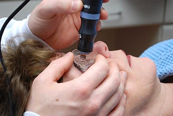 лечение катаракты