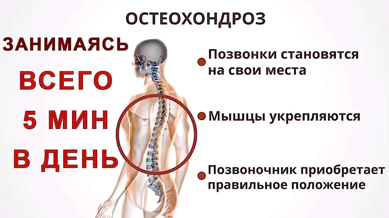 профилактика остеохондроза