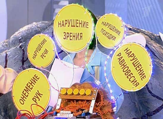 симптомы склероза