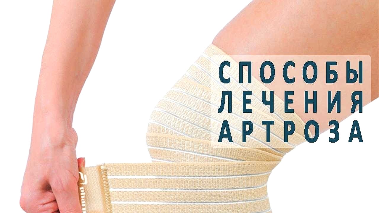 способы лечения артроза